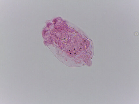 Brachionus Rotifer Multiple Specimens Lorica Morphology Light Micros