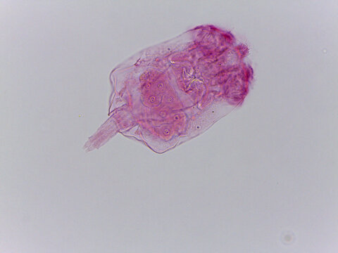 Brachionus Rotifer Multiple Specimens Lorica Morphology Light Micros