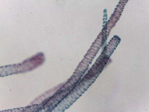 Hydra Freshwater Polyp Extended Tentacles Full Body View Light Microsc