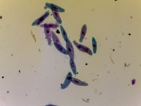 Paramecium Multimicronucleatum Multiple Individuals Dense Population Light Microsc
