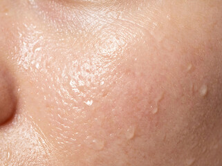 Fototapeta premium Close-up of human cheek with water droplets, detailed skin texture photo.