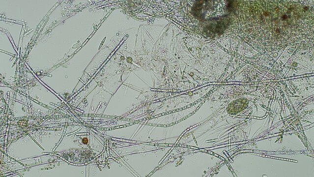 Cyanobacteria with pennate diatoms and ciliates at 10x