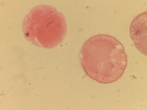 Early Embryonic Development Showing Spiral Cleavage Stages in Nereis Marine W