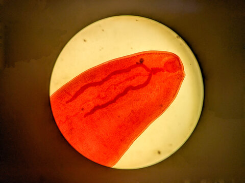 Microscopic View of Gastrothylax Parasitic Trematode Showing Distinctive Internal Ana