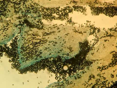 Microscopic View of Dark Elliptical Mushroom Spores on Glass Sl