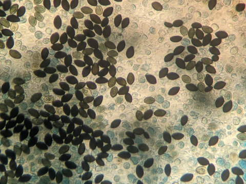 Microscopic View of Dark Elliptical Mushroom Spores on Glass Sl