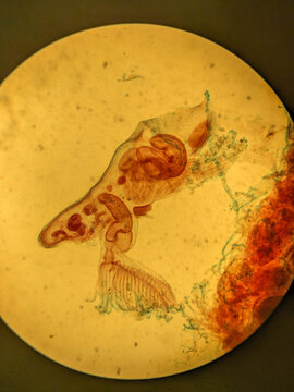 Microscopic View of Pectinatella Magnifica Bryozoan Colony Structure and Zo