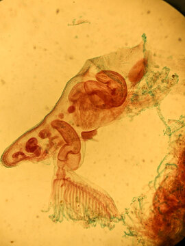 Microscopic View of Pectinatella Magnifica Bryozoan Colony Structure and Zo