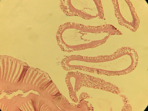 Microscopic Cross Section of Physalia Tentacle Showing Dactylozooid and Cnidocyte Batt