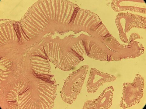 Microscopic Cross Section of Physalia Tentacle Showing Dactylozooid and Cnidocyte Batt