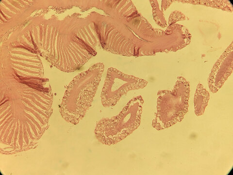 Microscopic Cross Section of Physalia Tentacle Showing Dactylozooid and Cnidocyte Batt