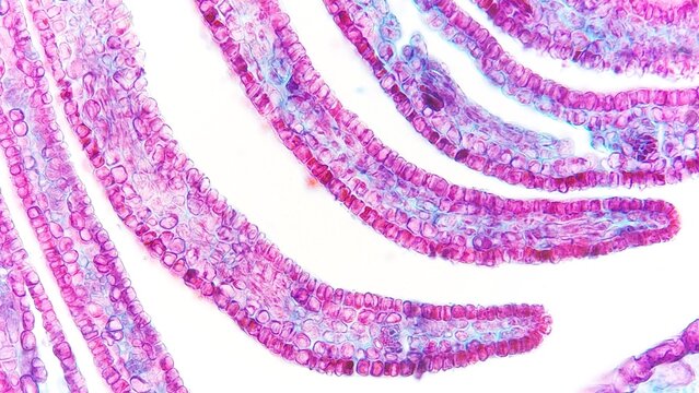 Histological section of a young peach sepal under the microscope
