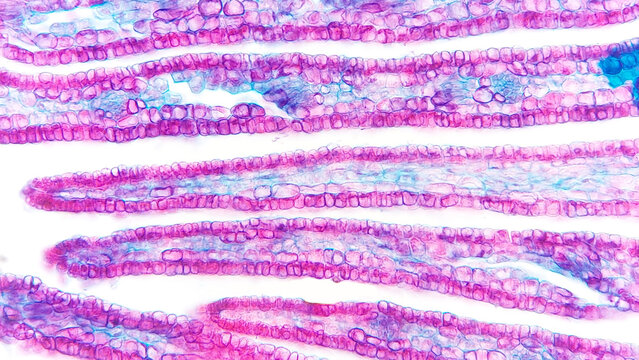 Histological section of a young peach sepal under the microscope