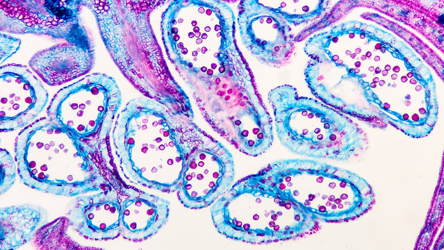 Transverse section of peach antheridia under the microscope