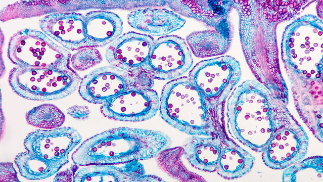 Transverse section of peach antheridia under the mkicroscope