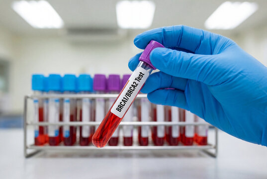Doctor holding blood sample tube labeled brca1 brca2 test