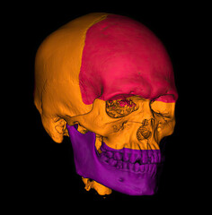 3D CT scan of skull with color segmentation showing cranial and facial bones. © Amri