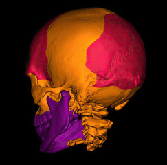 3D CT scan of skull with color segmentation showing cranial and facial bones. © Amri