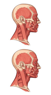 Medical anatomical illustration of human head and neck muscles in lateral side profile, showing facial musculature, masseter, temporalis, and sternocleidomastoid on white background.