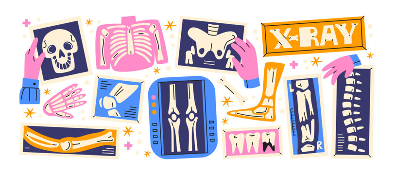 Xray medical radiology stickers retro cartoon style. Skeleton scans, broken bones, spine, skull, teeth and orthopedic diagnostics, hospital xray images and radiography collection