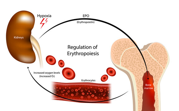 Regulation of Erythropoiesis Process Medical Infographic Kidney Hypoxia EPO Bone Marrow. EPO Production