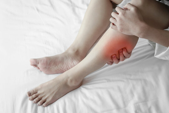 The young woman sat on a white bed, holding her calf where there were red marks, suggesting muscle pain, cramps, or injuries from exercise and healthcare.
