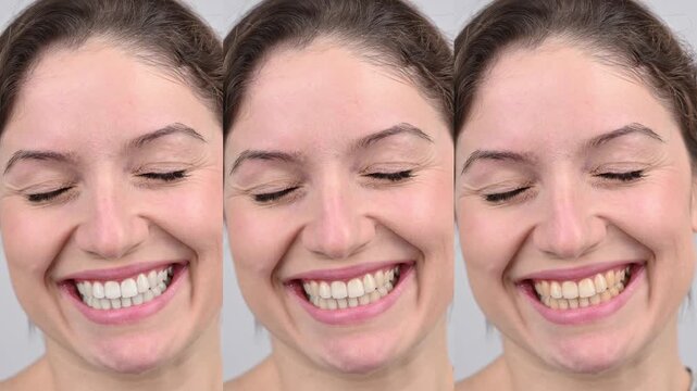 Caucasian woman smiling. Before and after teeth whitening. Collage. 