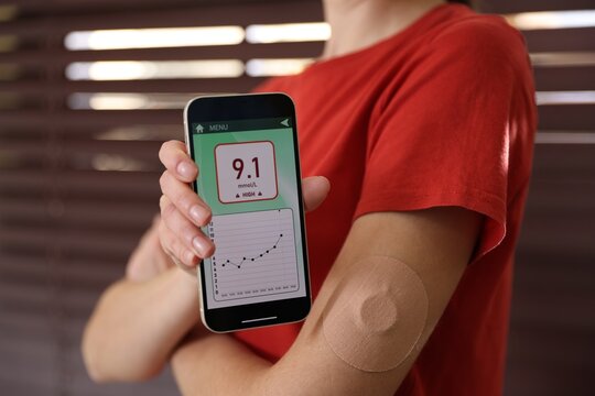 Diabetes. Woman with glucose sensor showing high blood sugar level on smartphone indoors, closeup
