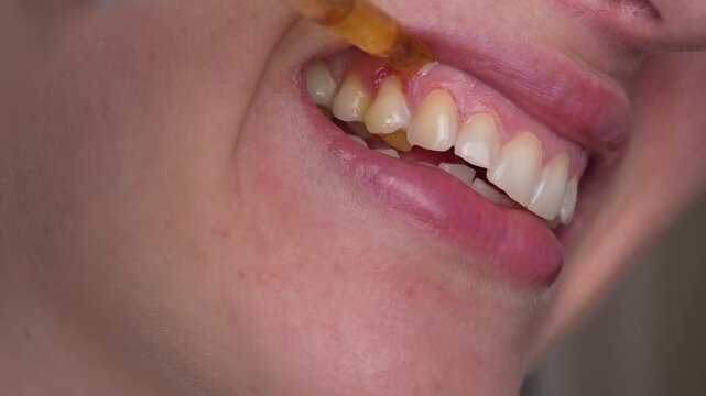 Macro close-up of woman teeth and gums with drop of dental liquid. Oral hygiene, dental care and treatment concept, healthy smile and dentistry.
