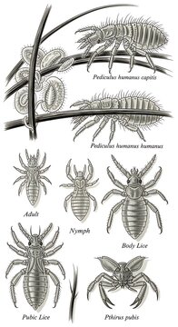 Detailed illustration of various lice species and their life stages on hair strands isolated on white background