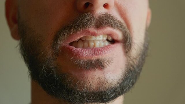 Close-up view of man smiling widely, revealing his teeth with dental aligners putted on. Dental care, orthodontics, bite or occlusion correction, teeth straightening