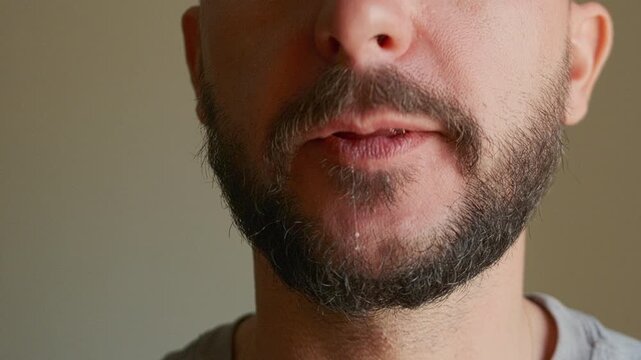 Close-up real-time footage of bearded caucasian man opens his mouth and removes transparent dental aligners off his teeth. Orthodontic treatment, bite or occlusion correction, teeth straightening