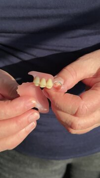 Close-up woman hands holding denture showcasing high-quality partial prosthesis patient inspecting fit and tooth detail against dark