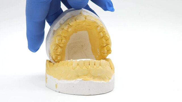 horizontal video of a plaster cast of the jaw in preparation for the installation of braces on the teeth on a white background. Dental care theme
