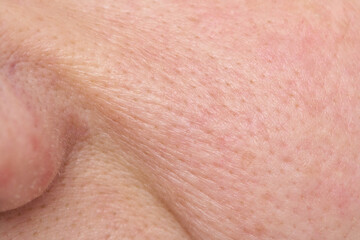 Naklejka premium Facial Cheek Skin Close Up Showing Pores Fine Wrinkles And Natural Complexion With Visible Texture And Facial Hair Follicles.