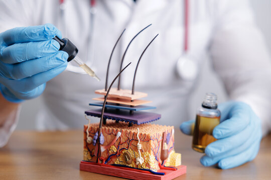 Doctor trichologist applying topical serum oil to skin model with visible hair