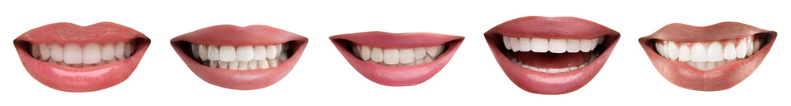Collage with smiles of different people on white background. Dental care for teeth health