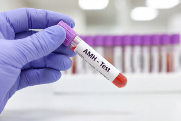 Naklejka premium Hand in purple glove holding blood sample tube labeled AMH test in lab