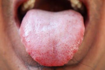 Fototapeta premium Close up of a human tongue showing visible papillae, texture details, and pink surface coloration.