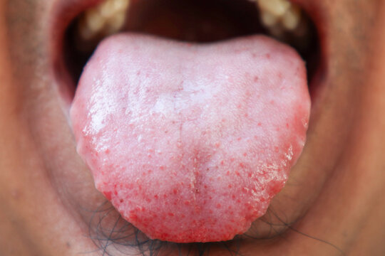 Close up of a human tongue showing visible papillae, texture details, and pink surface coloration.
