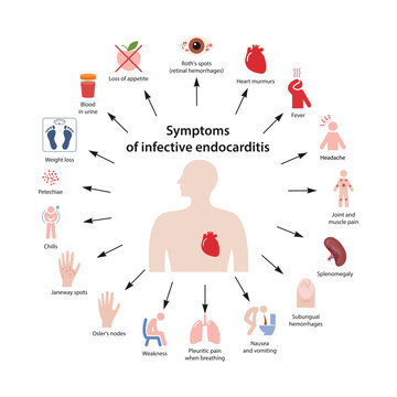 Symptoms of infective endocarditis. Circular diagram with the human body and icons of the main symptoms. Vector illustration in flat style, isolated on a white background.