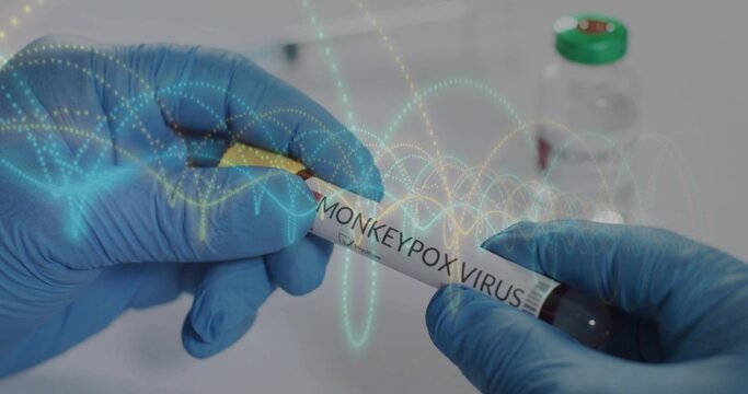 Handling tube labeled MONKEYPOX VIRUS in blue nitrile gloves at lab bench, blurred green-cap vial