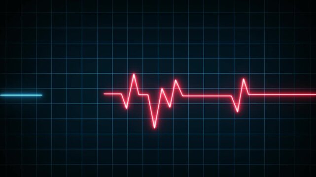 Heart Failure, Life Stopping, Medical Emergency, Health Crisis, Cardiac Arrest, And Critical Care Concepts. Medical Animation of a Green Heartbeat Wave 4k Animation video on Black Background