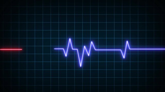 Heart Failure, Life Stopping, Medical Emergency, Health Crisis, Cardiac Arrest, And Critical Care Concepts. Medical Animation of a Green Heartbeat Wave 4k Animation video on Black Background