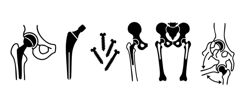 Hip replacement surgery implant icons, orthopedic joint procedure components, medical skeleton anatomy vector silhouettes for surgeon education, healthcare diagrams, prosthetic device, clinical bone r