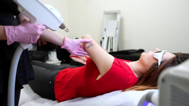 Female patient undergoing a tattoo removal procedure on her arm in a cosmetic clinic, with a beautician using advanced laser equipment for skin treatment and permanent ink removal