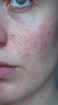 Close-up of a young woman showing natural complexion with visible pores and minor imperfections. Authentic beauty and skincare concept.