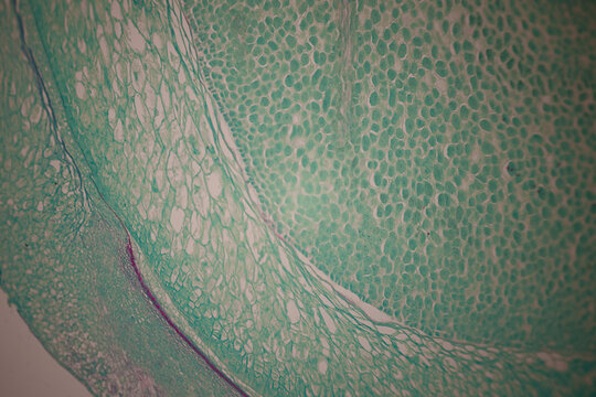 Microscopic section of green and magenta colored plant tissue showing layered cells, vascular zones, and organic textures.