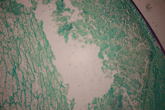 Microscopic section of green and magenta colored plant tissue showing layered cells, vascular zones, and organic textures.