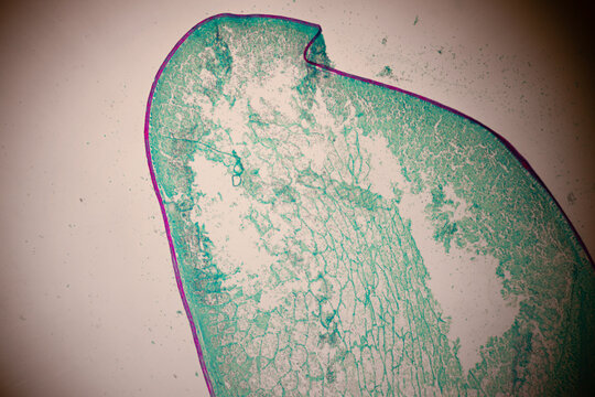 Microscopic section of green and magenta colored plant tissue showing layered cells, vascular zones, and organic textures.